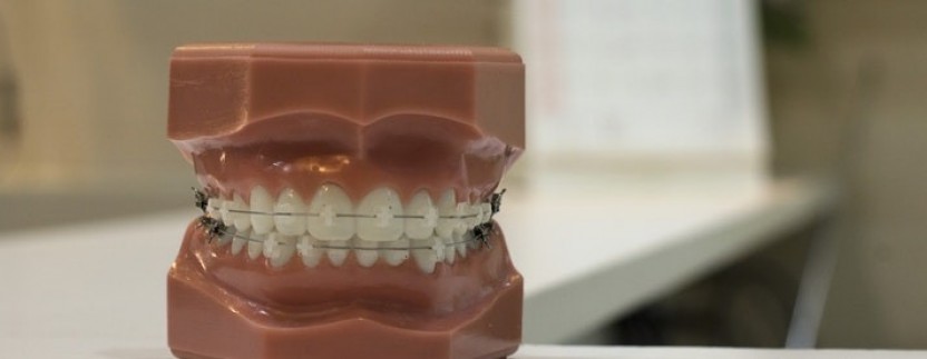 Dantų implantai, klinika Vilniuje